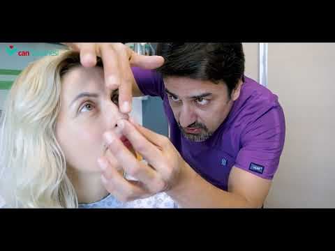 Burun Estetiği (Rinoplasti) - Op. Dr. Burak Kocagözoğlu videosunun kapak görseli