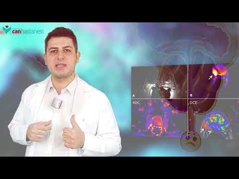 Doç. Dr. Uygar Miçooğulları, FEBU videosunun kapak görseli