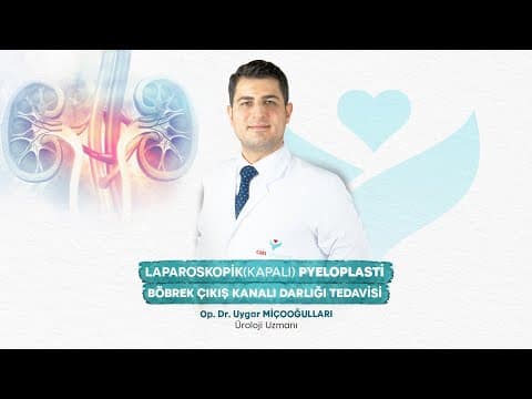 Laparoskopik Pyeloplasti - Üroloji Uzmanı Op. Dr. Uygar Miçooğulları videosunun kapak görseli