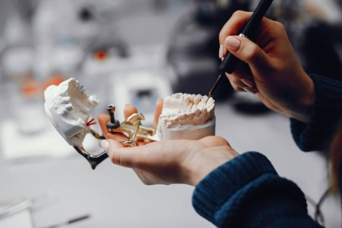 Diş implantı yaptırmadan önce dikkat edilmesi gereken 4 madde